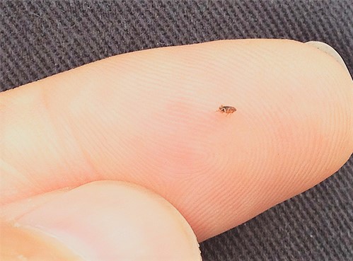 Курячі блохи на людині